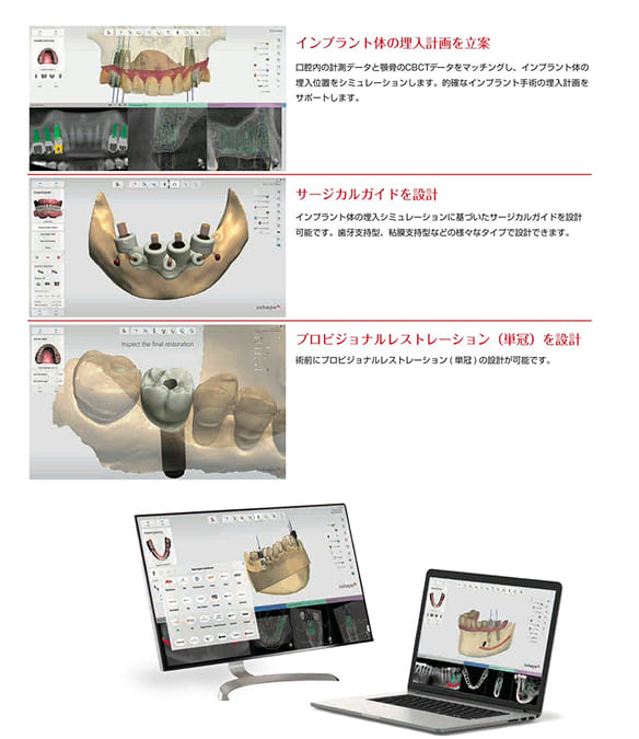 3Shape Implant Studio