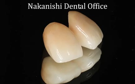 詰め物や被せ物を装着